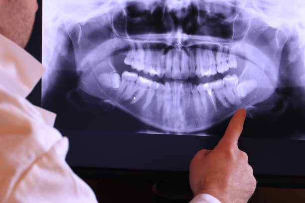 Professional Emergency Dental Service in AL