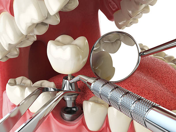 Reliable AL Emergency Dental Service Solutions